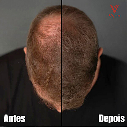 Vyon Premium Powder Hair - Homem