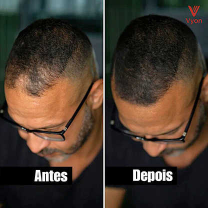 Vyon Premium Powder Hair - Homem