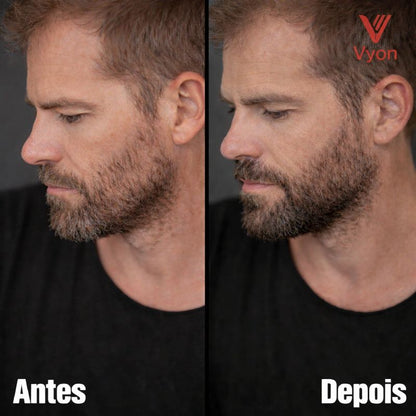Caneta Barba Cheia Vyon Beard Premium