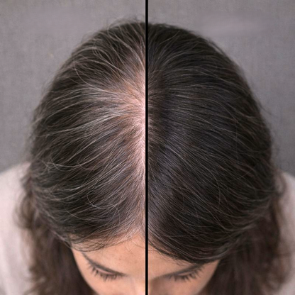 Vyon Premium Powder Hair - Mulher