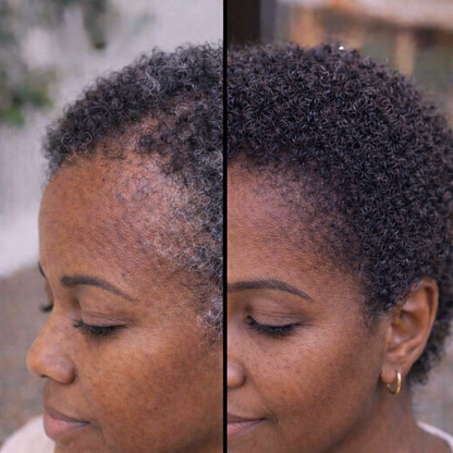 Vyon Premium Powder Hair - Mulher
