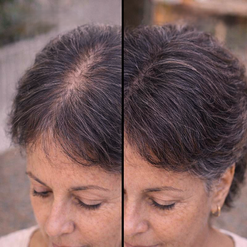 Vyon Premium Powder Hair - Mulher